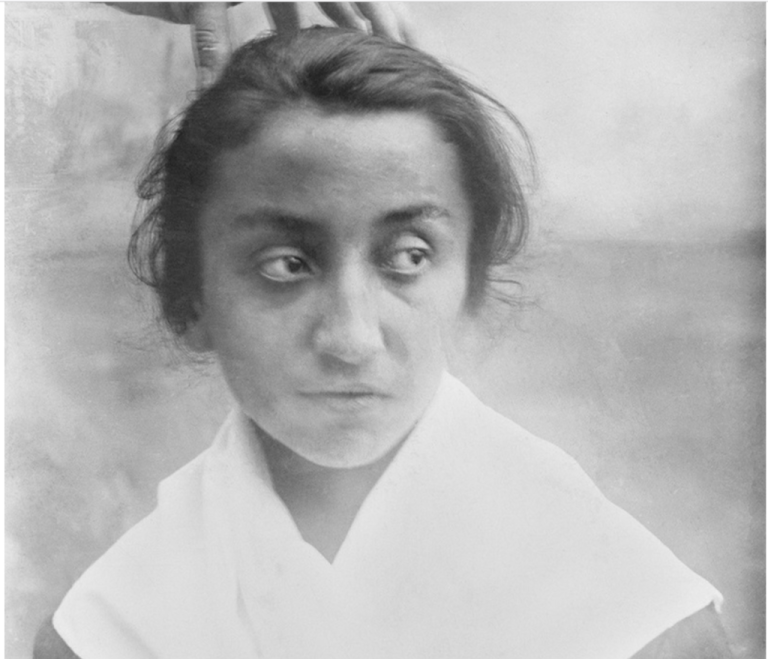 Lire la suite à propos de l’article Face à ce qui se dérobe : Les clichés de la folie.